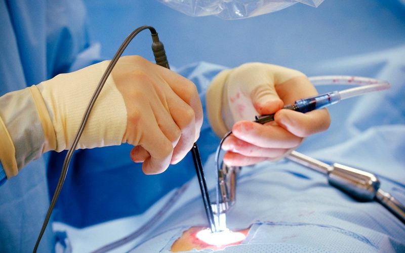 Laser Piles Treatment in Mohali: What Top Specialists Recommend