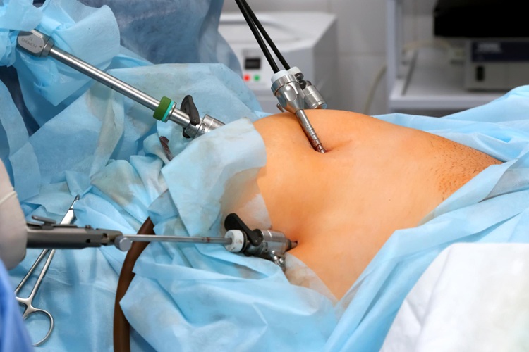 Lap Hernia Specialist in Chandigarh: Modern Techniques & Expert Care 