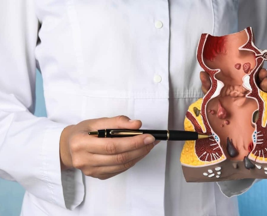 Hemorrhoid Treatment in Chandigarh: Non-Surgical & Surgical Options Explained 