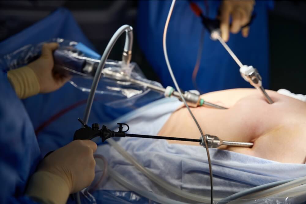 Laparoscopic Gallbladder Removal in Mohali: Safe, Quick & Effective Treatment