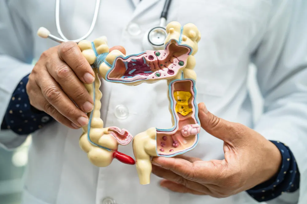 best piles doctor in Chandigarh