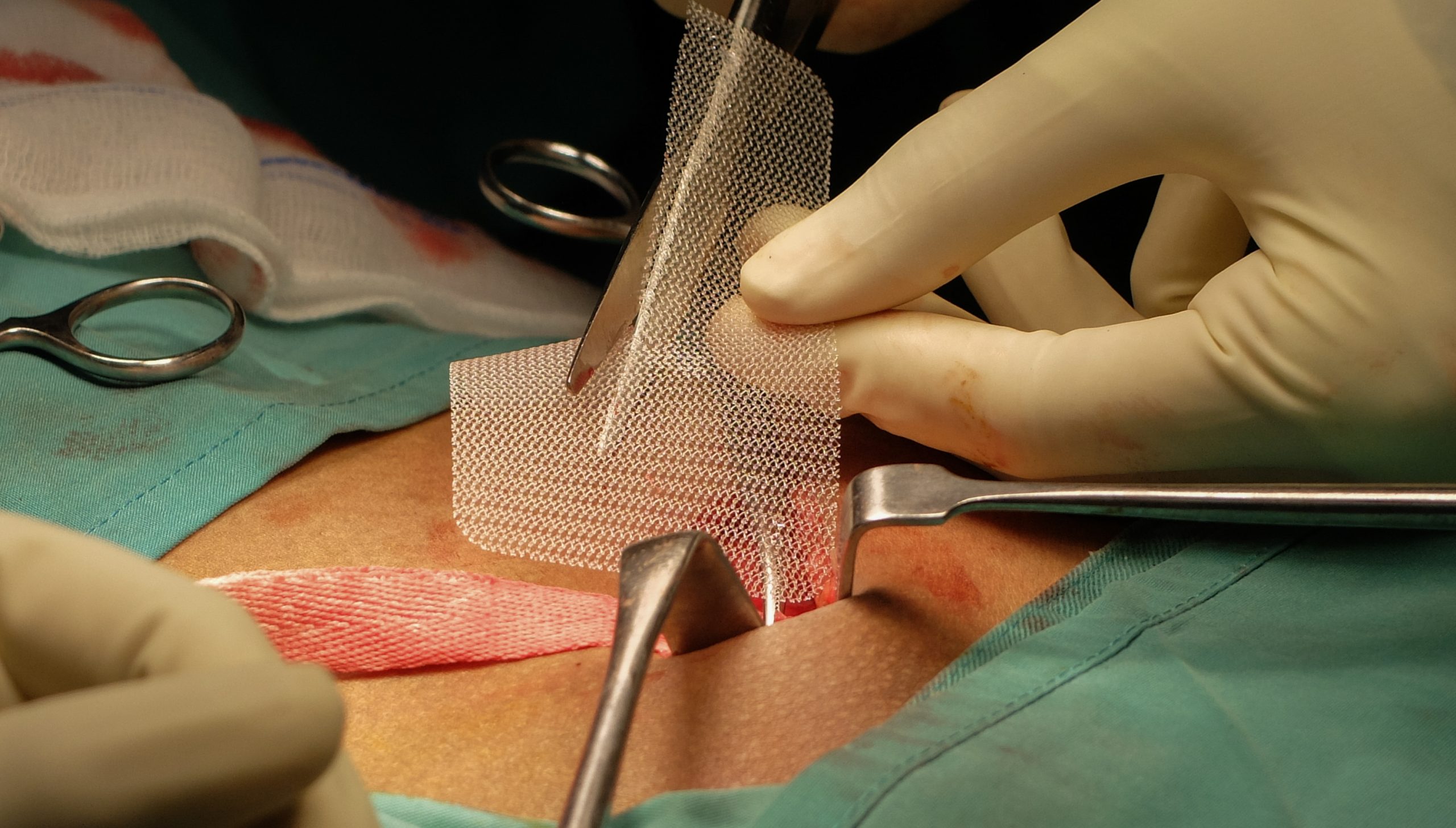 Why Visit a Lap Hernia Specialist in Chandigarh for Minimally Invasive Surgery
