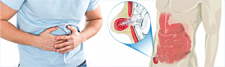 Hernia Surgery in Chandigarh: When and Why You Should Consider It