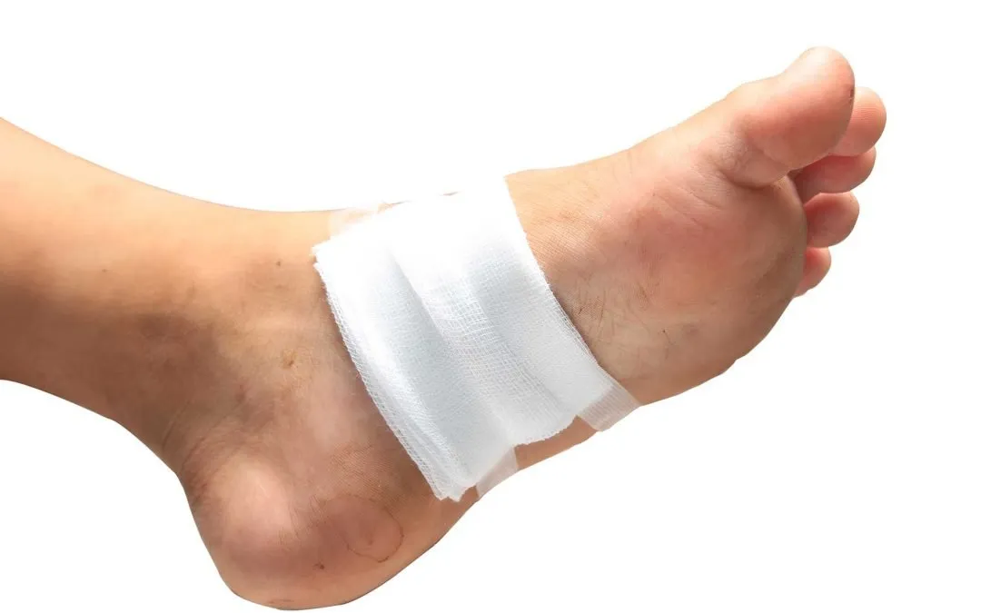 Expert Tips for Choosing the Best Diabetic Foot Ulcer Treatment Near Me